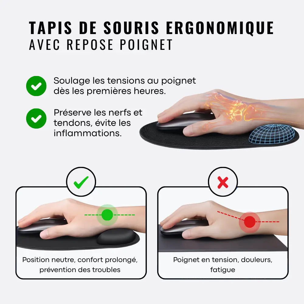 Tapis de souris ergonomique canal carpien conseils